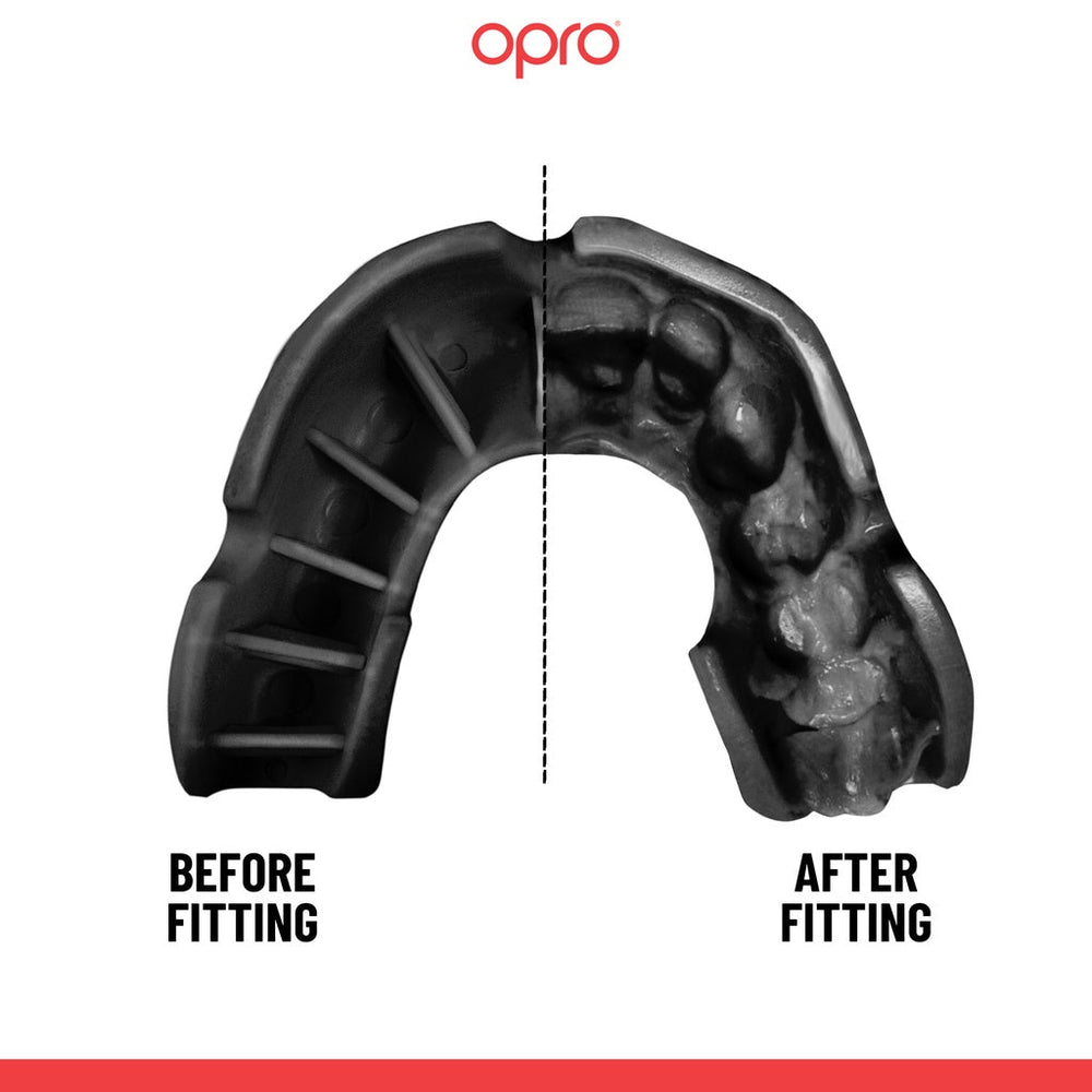 Opro Mouth Guard - Adults- Blue